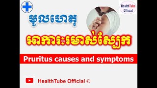 មូលហេតុ អាការៈរមាស់ស្បែក l Pruritus causes and symptoms ll HealthTube Official [upl. by Berl625]