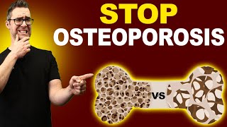 Top 7 Osteopenia amp Osteoporosis Treatments Symptoms amp Medications [upl. by Teufert]