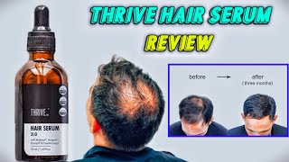 Thrive Hair serum Review After 3 months  Best Serum for hairfall and Hair loss [upl. by Ailadgim]