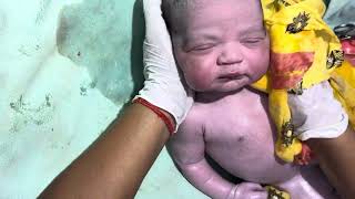 New born baby 👶 Baby cutedoctor newmother shortvideo viralvideo doctorbantu cute cutekids [upl. by Odlamur]