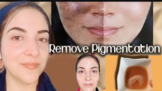 Homemade face mask for pigmentation darkspots How to get clear glowing skin [upl. by Aerdnaeel]