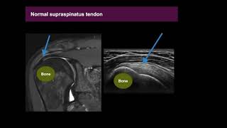 Musculoskeletal MSK Ultrasound Basics [upl. by Ahsinek272]