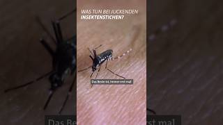 Mücken Wespen Bienen Die besten Hausmittel bei Insektenstichen 🐝😫  Marktcheck SWR shorts [upl. by Laekim939]