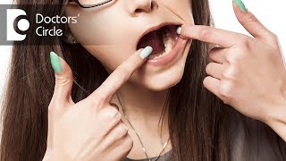 How to prevent Dental Caries  Dr Jayaprakash Ittigi [upl. by Alesi61]