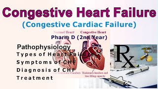 Congestive cardiac failure [upl. by Carney974]