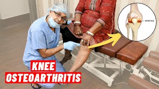 Knee Osteoarthritis Chiropractic Treatment I Dr Sanjay Sarkar USA I Call 9903026262 [upl. by Amocat]