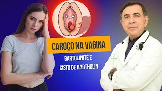 Qual o tratamento para cisto abscesso de glândula de Bartholin [upl. by Trish]