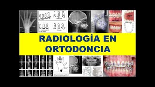 quotRADIOLOGÍA EN ORTODONCIA BASADA EN EVIDENCIASquot [upl. by Dahaf]