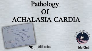 Achalasia Cardia  Pathophysiology  GIT Motility Disorders  GIT Pathology [upl. by Aihsercal]