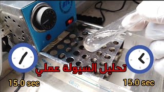 عملي البروثرومبين PT manualOpticalMagnetic [upl. by Ivah]