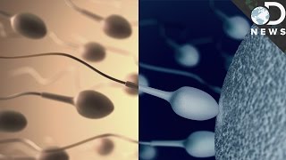 This Device Could Turn Off Your Sperm [upl. by Adnala495]