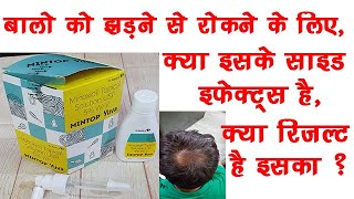 Mintop Yuva Solution 5 Minoxidil  DrReddys Mintop  Minoxidil Work🔥🔥 [upl. by Tnayrb432]