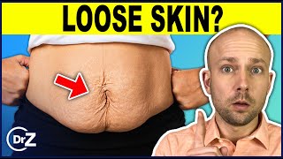 How To Tighten Loose Skin  This Really Works [upl. by Nivart466]