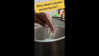 Latent Heat🔥 why steam causes severe burns shorts science chemistry [upl. by Ramar]