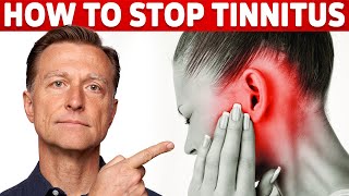 How to Stop Tinnitus ringing in the ears – Try DrBergs Home Remedy to Get Rid of It [upl. by Graubert247]