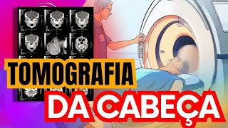 Agora você vai entender como é feito uma tomografia da cabeça radiologia [upl. by Dorene]