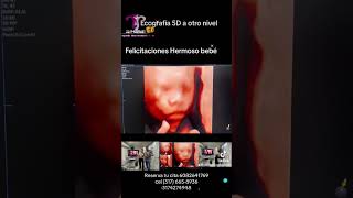 ecografia5d 4d5d bebe baby embarazo 3174274948 [upl. by Siuluj516]