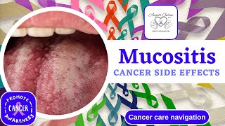 Understanding Mucositis A Side Effect from Cancer Treatment  Symptoms Management amp Home Remedies [upl. by Lamrouex]