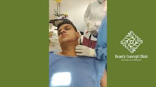 Me Hicieron Lipo de Papada Bichectomia y Perfilamiento Facial SalmitaBebe [upl. by Horten]