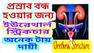 Discussion of Urethral Strictureপ্রস্রাব এর দার শুরু হয়ে যাওয়াcausesHomeopathy Treatment [upl. by December285]