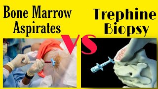 Bone Marrow Aspiration and Trephine Biopsy Technique Urdu amp Hindi [upl. by Aiuqenehs]