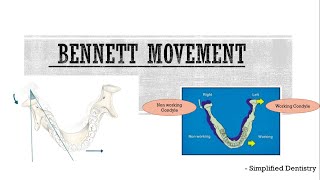 Bennett movement [upl. by Jorgan778]