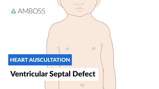 Ventricular Septal Defect VSD  Heart Auscultation  Episode 11 [upl. by Vatsug]