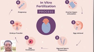 IN VITRO FERTILIZATION  ZOOLOGY [upl. by Gersham896]