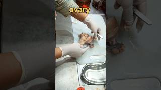 Ovary tissue sample ovary கருமுட்டை pathology pcodpcos pcos ovariancyst ovariandisease [upl. by Hafeetal184]