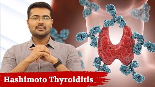 Watch This If You Have Thyroid ProblemHashimoto Thyroiditis  Dr Manoj Johnson [upl. by Aik51]