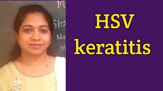 HSV KERATITIS Herpes simplex virus Keratitis classification Clinical featuresDendritic ulcer [upl. by Annauqahs541]