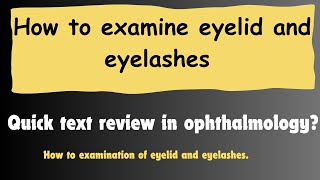 examination of eyelid  How to check eyelids and eyelashes OptometryFans [upl. by Ilarrold]