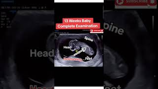 13 weeks pregnancy baby growth🥰🥰🥰viral trending [upl. by Sarina602]