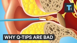 Why QTips are bad [upl. by Anoli]