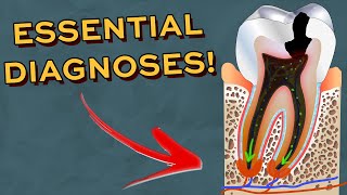 Every Dentistry Diagnoses you NEED to know when seeing patients [upl. by Olegnad]