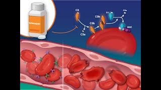 Iptacopan for Paroxysmal Nocturnal Hemoglobinuria  NEJM [upl. by Ericka]