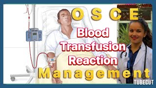 Blood Transfusion reaction Management for OSCE [upl. by Lasala756]