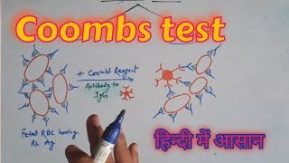 Coombs test in hindi [upl. by Kegan]