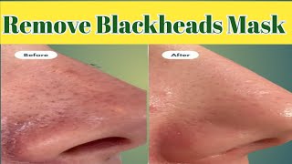 Remove Blackhead Mas  How TO Get Rid Of Blackhead And Whitehead Fatima health and beauty secrets [upl. by Fawn13]