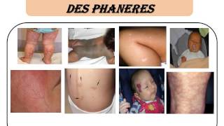 PEDIATRIE Examen clinique du nourrisson [upl. by Ancel879]