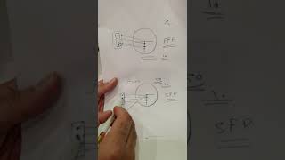 شرح الفرق بين FFP و SFP في الدرابيل معلومات مهمه FFP VS SFP [upl. by Gabbi590]