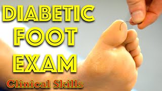 Diabetic Foot Examination  Clinical Skills  Dr Gill [upl. by Malamut]