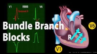 ECG part 10 Left amp right bundle branch block [upl. by Eiramait559]