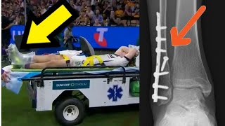 Ryan Papenhuyzens SEASON ENDING ANKLE FRACTURE Explained [upl. by Ynagoham]