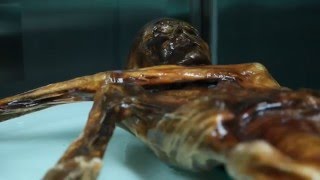 Ötzi Forschung Das Erbe der SteinzeitBakterien [upl. by Blount]