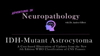 IDH  Mutant Astrocytoma Update from the 5th Edition WHO Classification of CNS Tumors [upl. by Beitch350]