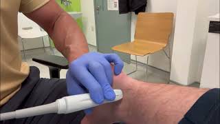 Flexor Hallucis Longus tendon injection by ultrasound guidance [upl. by Lotsirb]