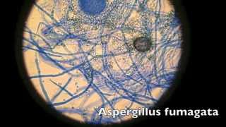 How to make your phone into a microscope [upl. by Ohs203]