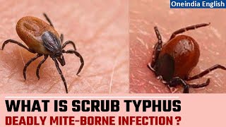 Scrub Typhus kills 5 in Odisha 9 in Shimla  Know about this deadly infection  Oneindia News [upl. by Acirederf]