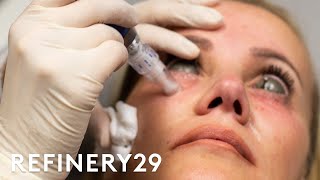 The Truth About This Controversial Injection Trend  Shady  Refinery29 [upl. by Gilbertson776]